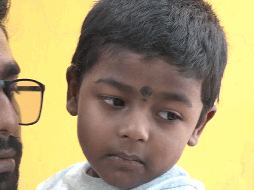 West Bengal Child Needs ₹9 Crore Injection; Family Spends ₹12 Lakh Monthly