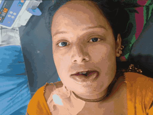 राखी के हल्दी लगने के बाद होंठ फूल गए और पूरे शरीर पर लाल चकत्ते पड़ गए थे।