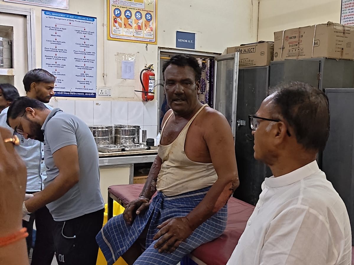 लदूना में गैस सिलेंडर लीकेज से आग, चार झुलसे:  नई टंकी लगाते समय तेज प्रेशर से निकली LPG, पूरी रसोई बनी आग का गोला – Mandsaur News