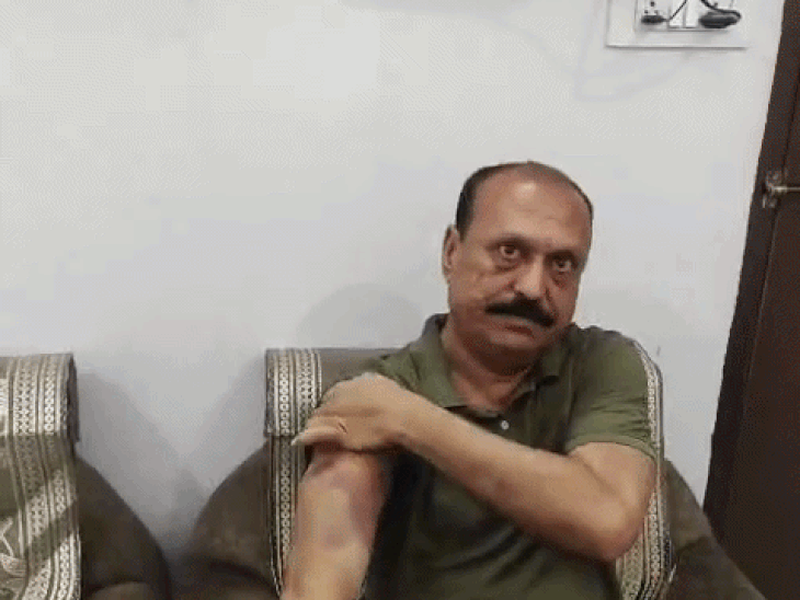पिटाई की वजह से हाथों पर बने निशान दिखाते पूर्व भाजपा जिलाध्यक्ष।