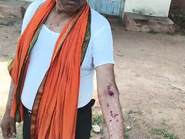 भालू ने ग्रामीण पर हमला किया जी से उसके हाथ में चोटआई है।