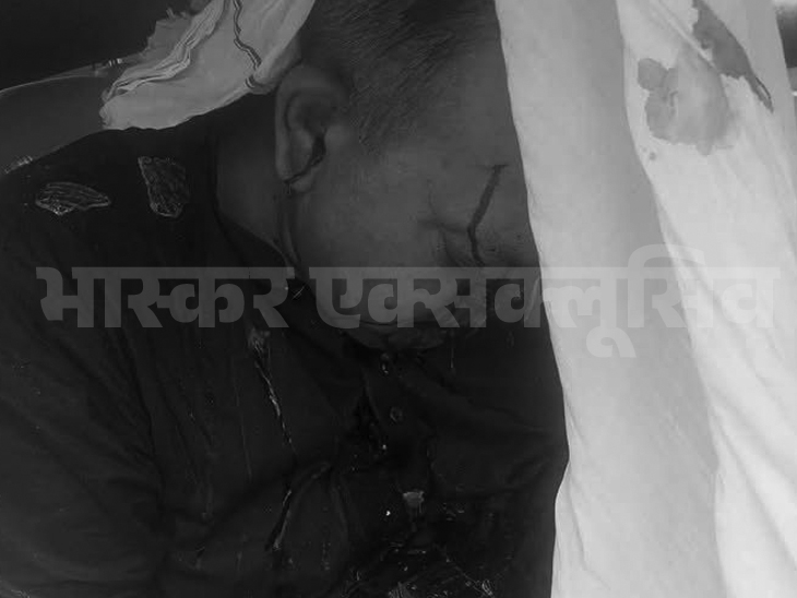 आतंकी हमजा बुरहान की गुरुवार को मुजफ्फराबाद के AIMS कॉलेज के बाहर हत्या कर दी गई।