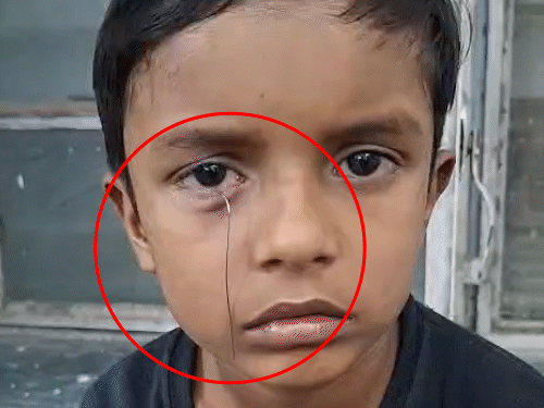 कार को आगे-पीछे करते समय तार अचानक निकलकर आंख में घुस गया।