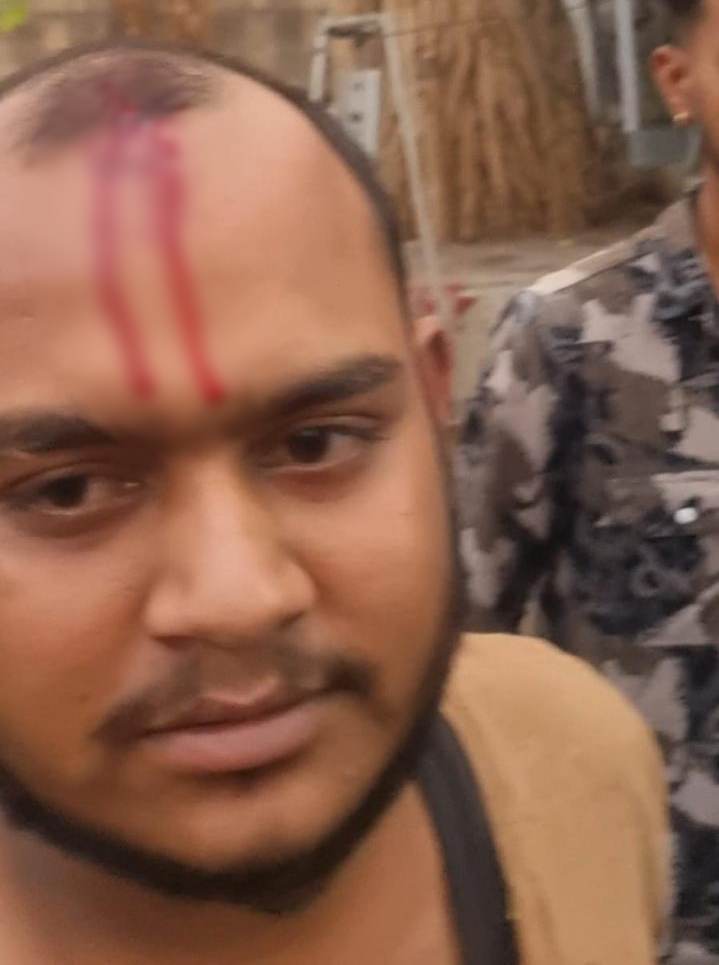 सिर पर हमले से युवक को चोट आई है।