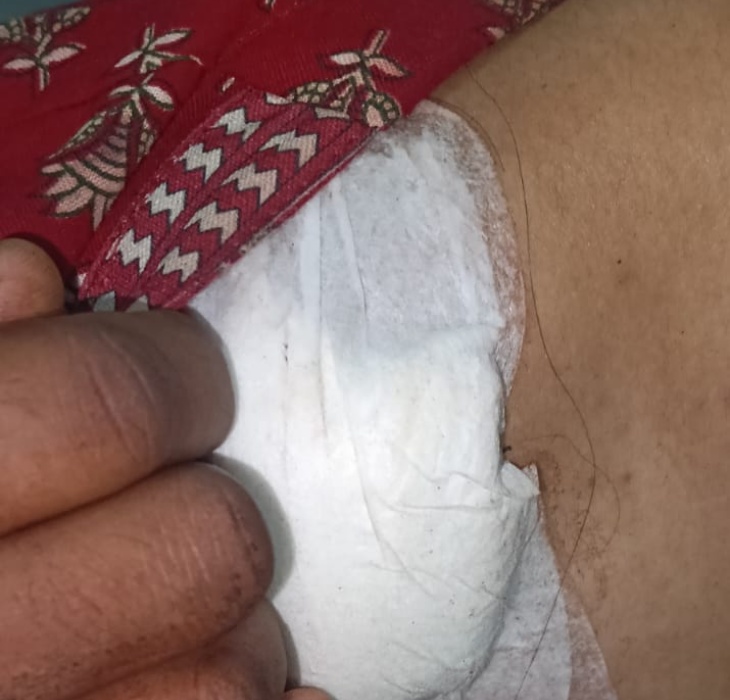 आरोपी ने लड़की के कंधे पर भी चाकू से हमला किया।