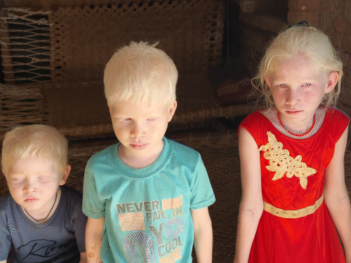 बच्चों को धूप में सही से दिखाई नहीं देता।