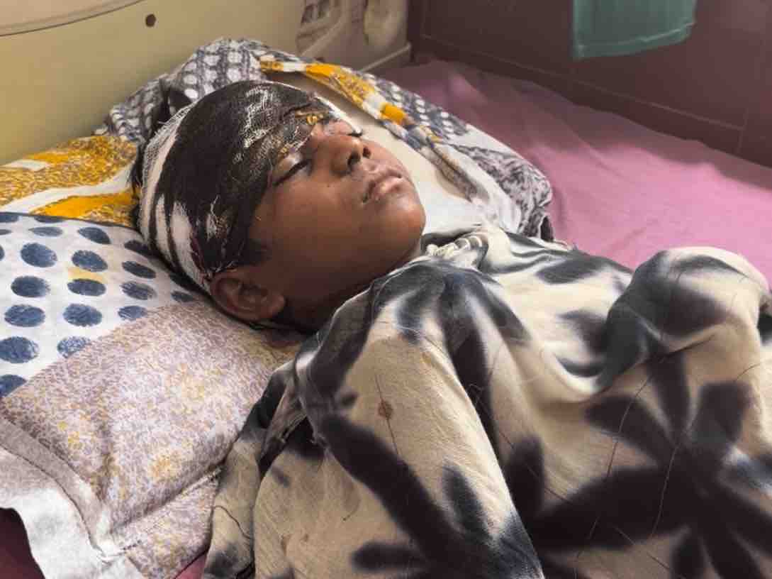 6-Year-Old Child Critically Injured by Stray Dogs in Gangapur ...