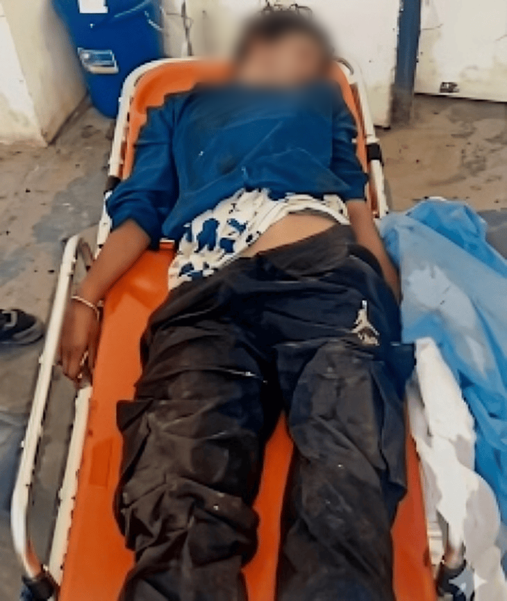 युवती के चेहरे पर चोट के निशान हैं। फिलहाल उसका शव राजिंदरा अस्पताल में रखवाया गया है।