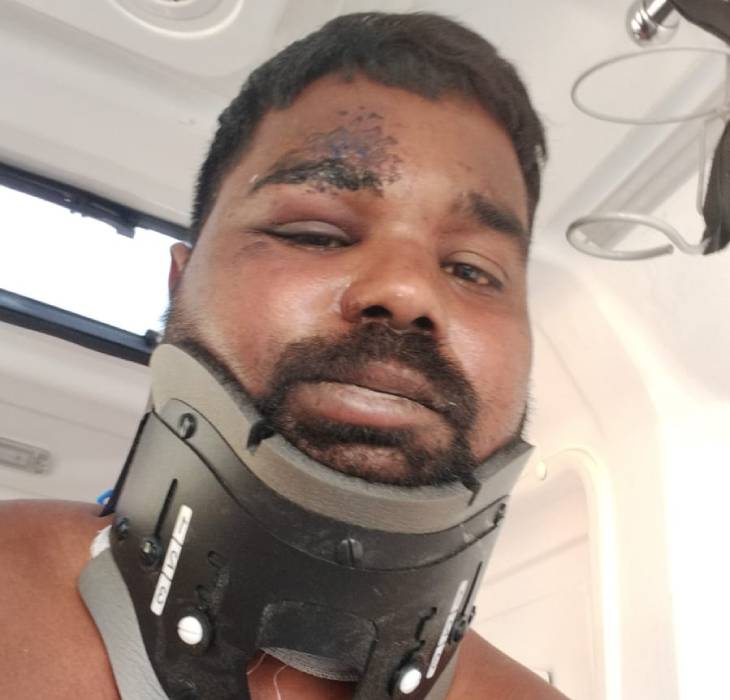 गंजाम के कोथारसिंग गांव के रहने वाले तेजेश्वर रेड्डी भी ड्रोन हमले में घायल हुए हैं और मॉस्को में उनका इलाज चल रहा है।