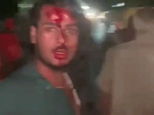 दूसरे पक्ष के सतिंदर और अन्य लोग घायल हुए हैं और सिविल में दाखिल हैं।