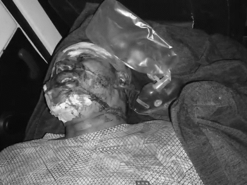 प्राइवेट अस्पताल में उसकी जांच की गई, लेकिन तब तक उसकी मौत हो चुकी थी।