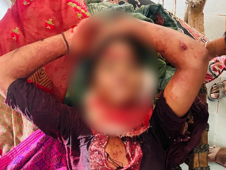 नाबालिग की गंभीर हालत होने के चलते उसे ग्वालियर रेफर कर दिया गया है।