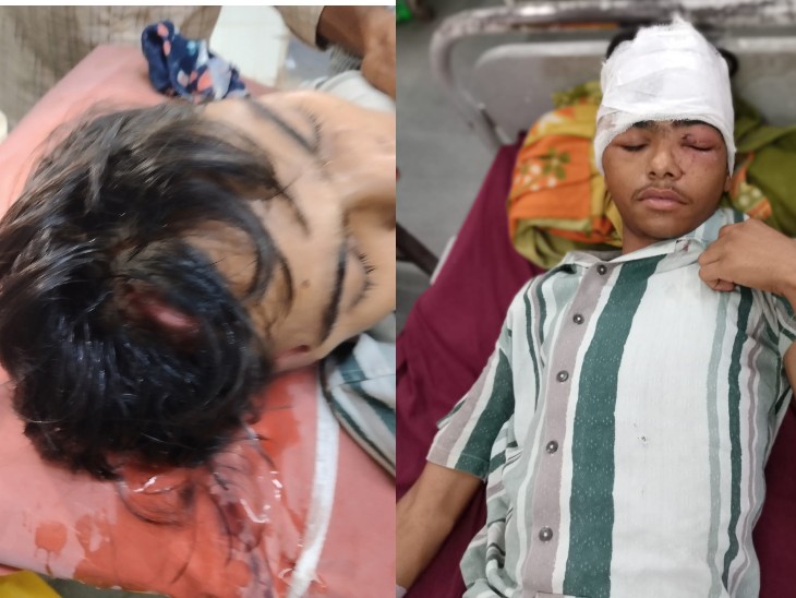 राज के सिर में दो जगह गहरे घाव हो गए।