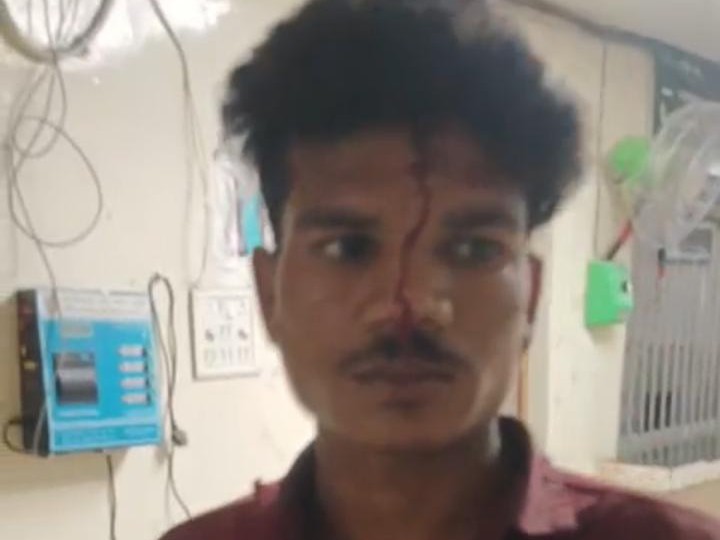 सिर में धारदार हथियार लगने से आठ टांके आए हैं