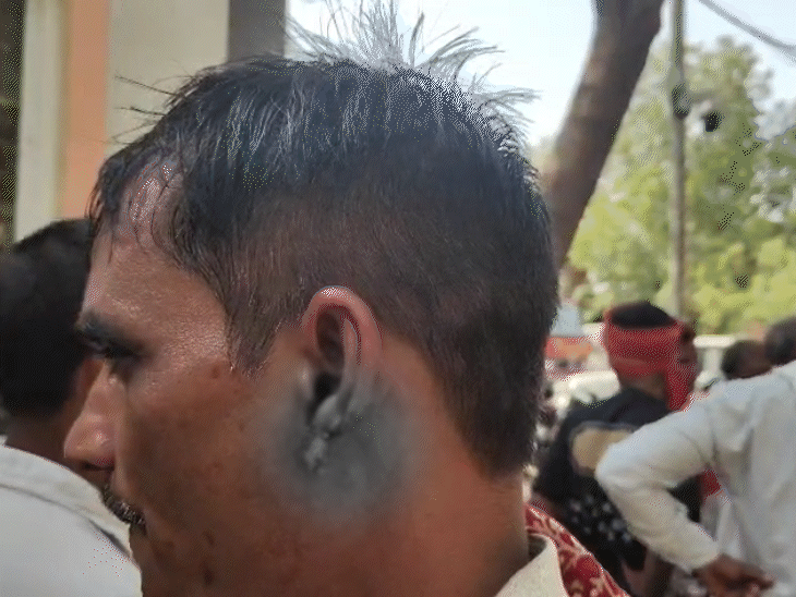 कान के निचले हिस्से का एक हिस्सा काट दिया गया है.