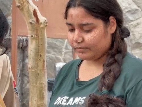 राजस्थान के उदयपुर सरकारी रेजिडेंसी स्कूल में नोज पिन नहीं निकलने पर छात्रा की नाक पर टेप चिपकाया गया।