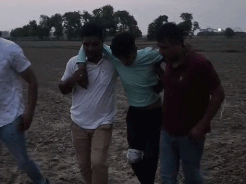 रोहतक में एनकाउंटर में घायल हुए बदमाश को लेकर जाती पुलिस। - Dainik Bhaskar