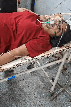 लखनऊ अग्निकांड- विद्यार्थ्याने पहिल्या मजल्यावरून उडी मारली, ग्रीलवर आदळला: जळत्या दुकानातून मांजरींना वाचवले, मृतदेह पाहून उपमुख्यमंत्रीही रडले; 15 फोटो आगीत जखमी झालेल्या लवप्रीत या महिलेला गंभीर अवस्थेत रुग्णालयात दाखल करण्यात आले, जिथे त्यांची प्रकृती चिंताजनक आहे.