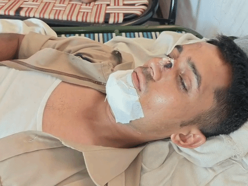 हादसे में 7 पुलिसकर्मी घायल हो गए।