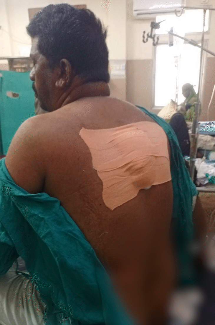 चाकू के हमले में मेहरबान की पीठ पर गहरा घाव हो गया।