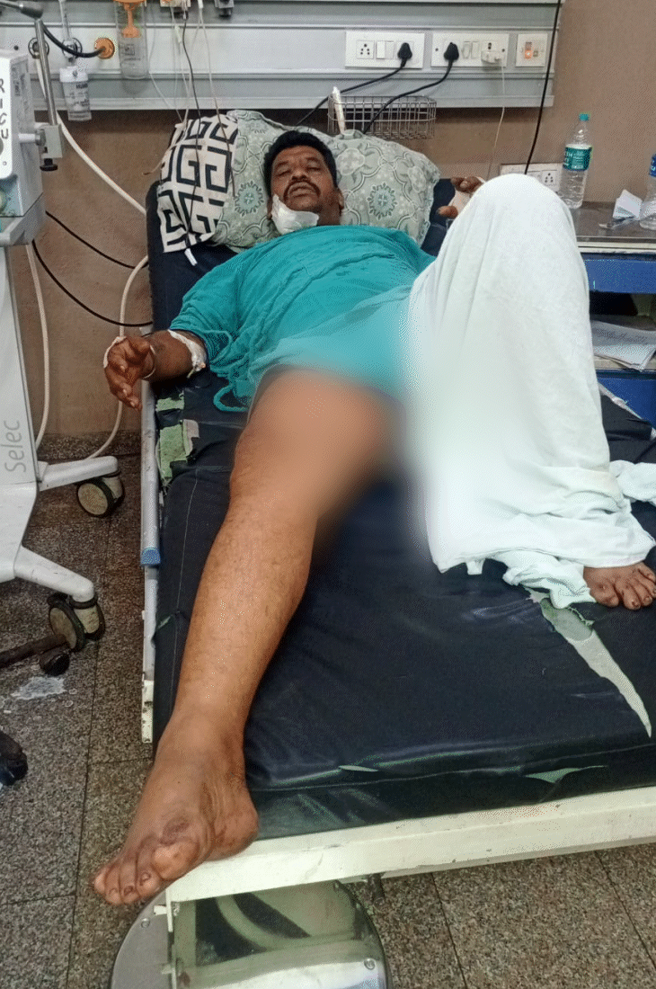 घायल मेहरबान को एमवायएच में भर्ती कराया गया है।