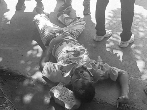 सीन 3- जयंत बिल्डिंग से नीचे सीधे ग्रिल पर गिरे। इससे गंभीर रूप से घायल होकर अचेत हो गए। उन्हें केजीएमयू के ट्रॉमा सेंटर में भर्ती कराया गया।