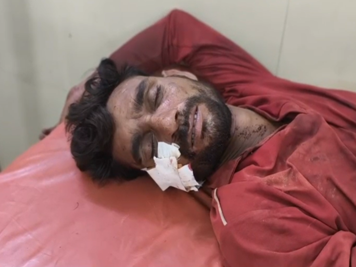 आरोपी ड्राइवर को चोटें आई है, उसे मानपुर अस्पताल में भर्ती कराया गया है।