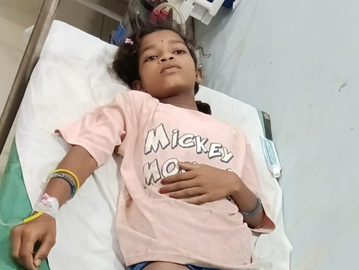 एक बच्ची झुलस गई। उसकी जान भी बाल-बाल बची।