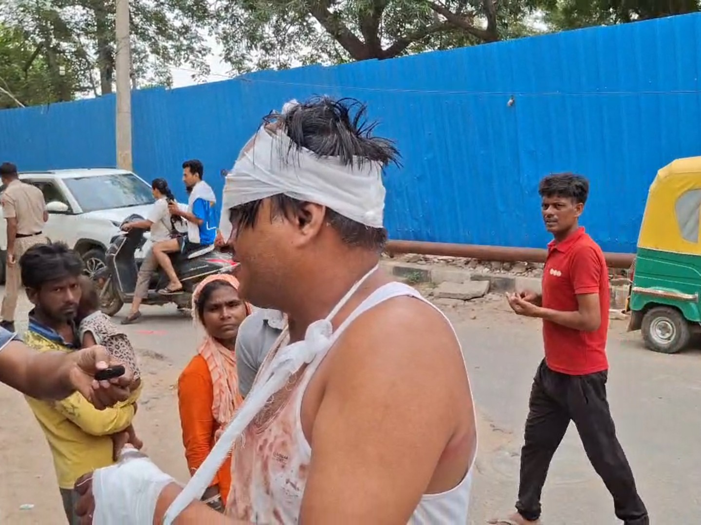 मारपीट में घायल हुआ कृष्ण कुमार।