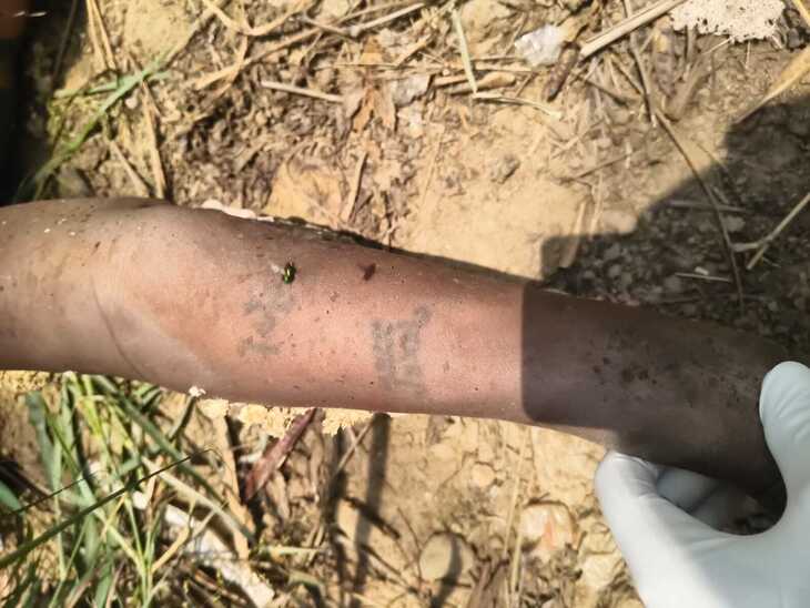 The deceased woman also has obscure tattoos on her hands, which are being decoded by forensic experts.