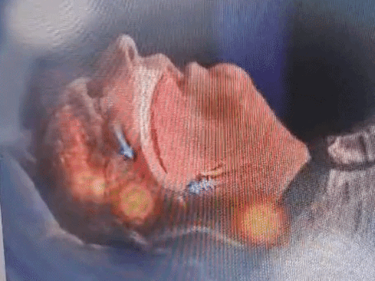 इस तरह ऑक्सीजन का स्तर गिर जाता है।
