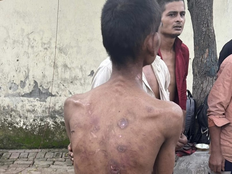 मजदूरों के शरीर पर गंभीर चोटों के निशान मिले थे। उन्हें फैक्ट्री में यातनाएं दी गई थीं। - Dainik Bhaskar