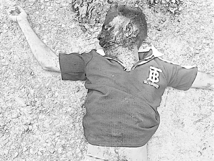 हादसे के बाद खून से लथपथ विकास।