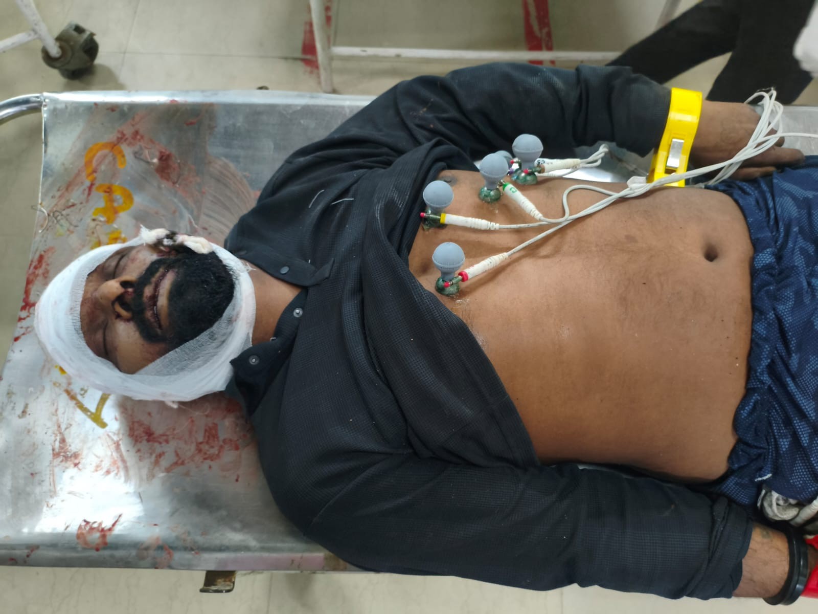 एक युवक का इलाज के दौरान आज मौत हो गई।