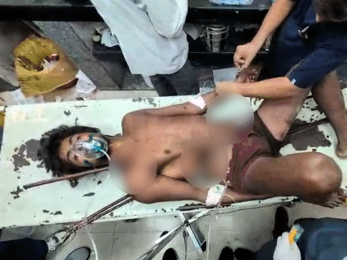 KGMU ट्रॉमा सेंटर में घायल युवक का इलाज करने वाली डॉक्टरों की टीम। - Dainik Bhaskar