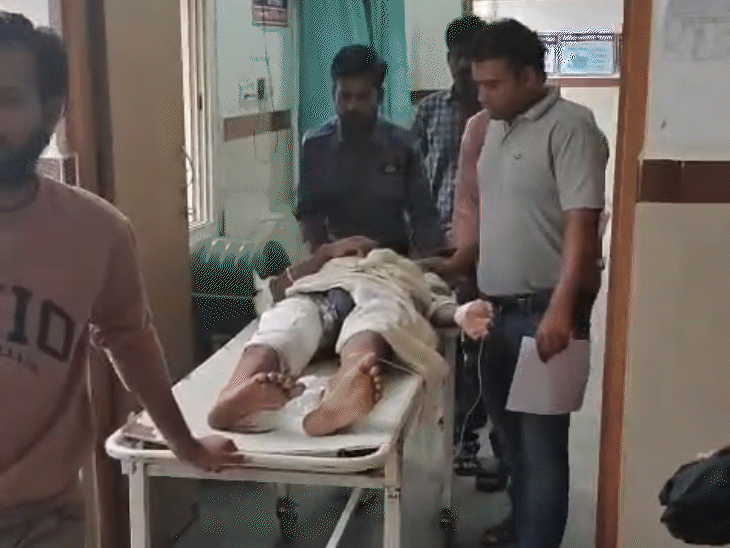 संदीप का शरीर जल गया और गाड़ी फिसलने से उसका पैर फ्रैक्चर हो गया.