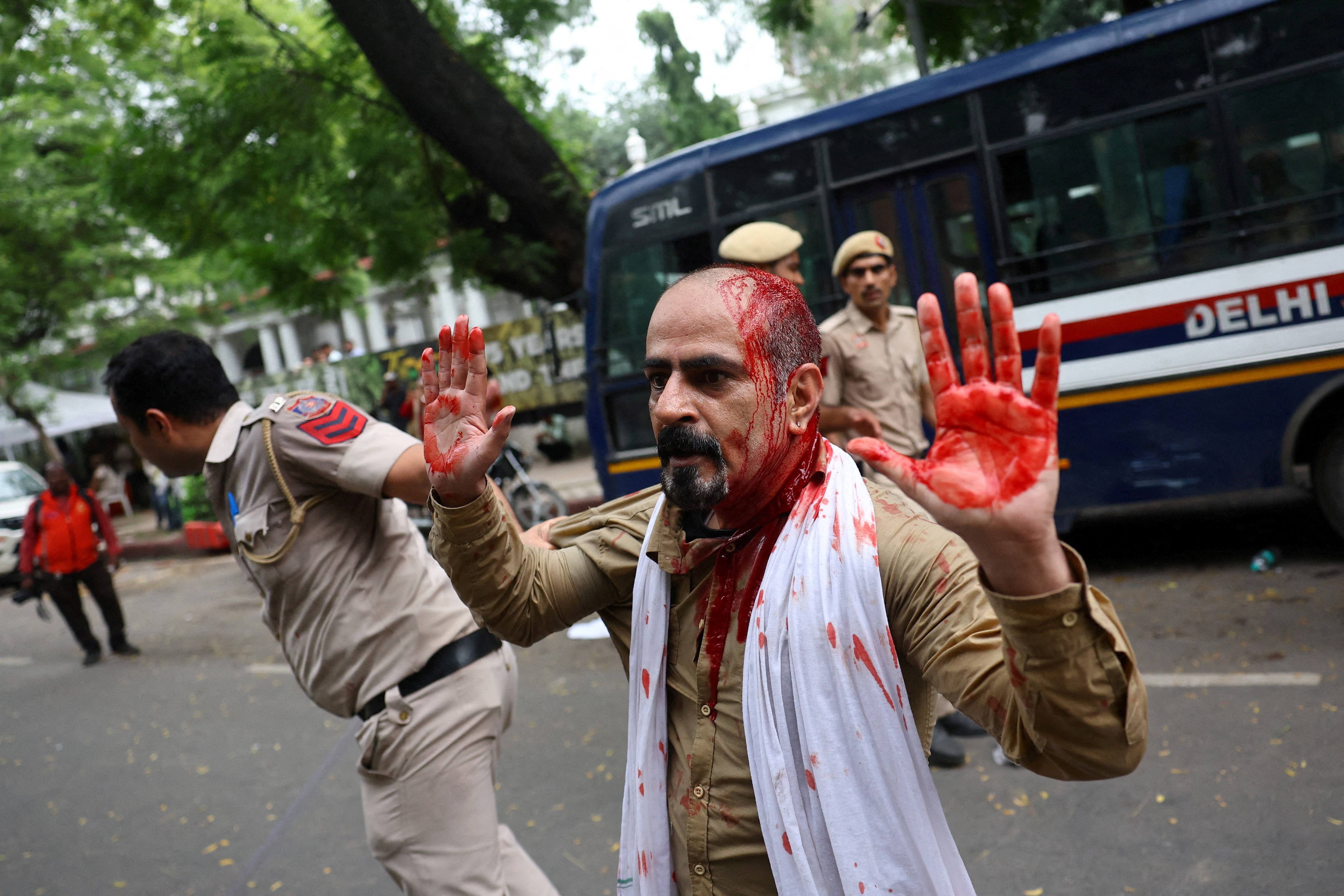 दिल्ली पुलिस के लाठीचार्ज से एक प्रदर्शनकारी के सिर पर चौट आई।
