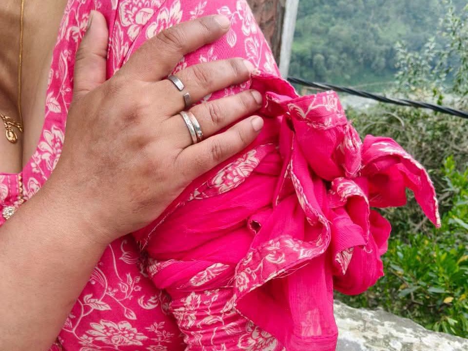 युवक के हमले से घायल महिला।