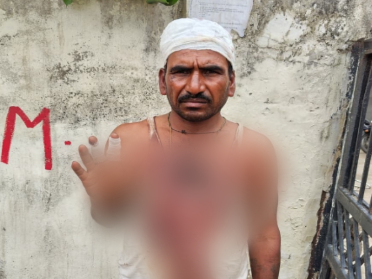 खून से लथपथ छोड़कर भागे, मोबाइल तोड़ा; 50 हजार का चालान भरने पर कहासुनी|जयपुर,Jaipur - Dainik Bhaskar