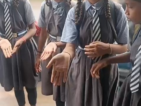 छात्राओं ने अपनी हथेलियां दिखाईं।