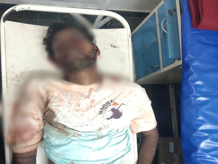 मौत के बाद अस्पताल में करण की लाश।