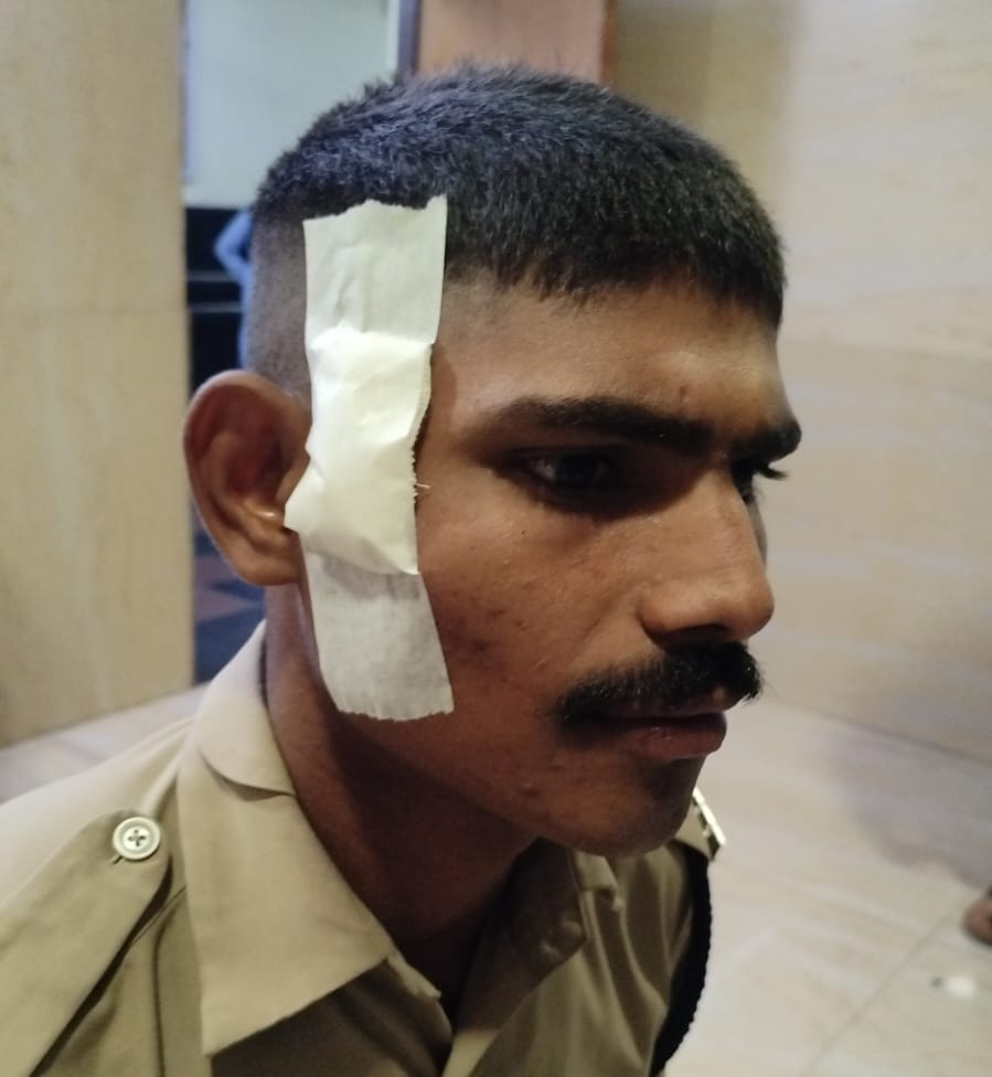 प्रदर्शन के दौरान पुलिसकर्मी के कान के पास चोट आई है।