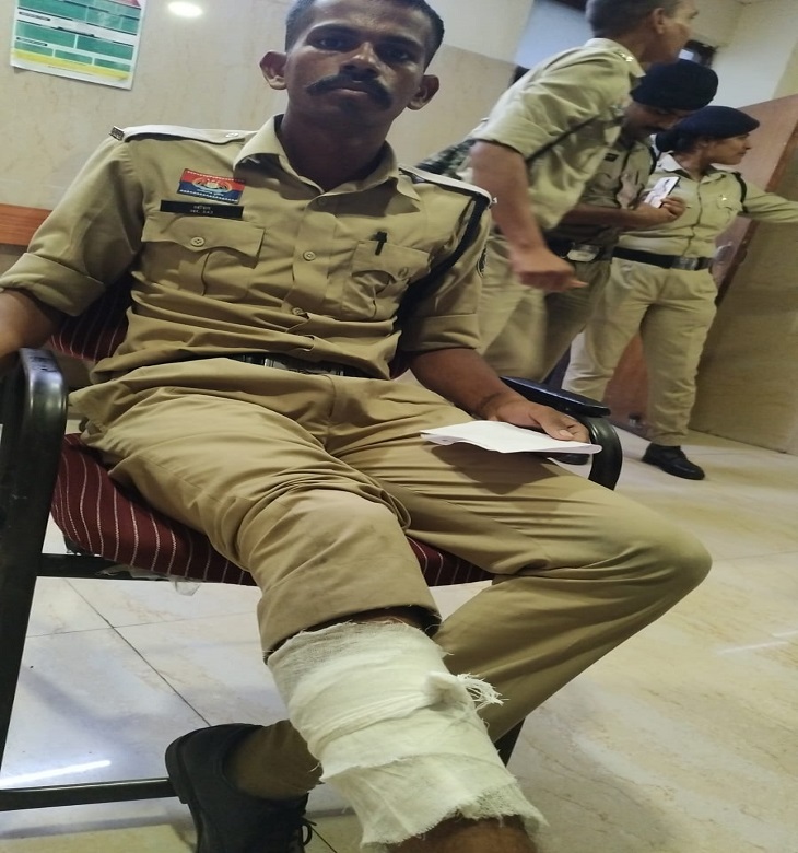 पुलिसकर्मी के दाहिने पैर में चोट लगी है।