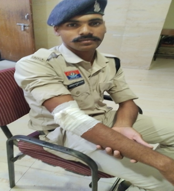 इनके हाथ में चोट आई है, घायल पुलिसकर्मी की ड्रेसिंग की गई है।