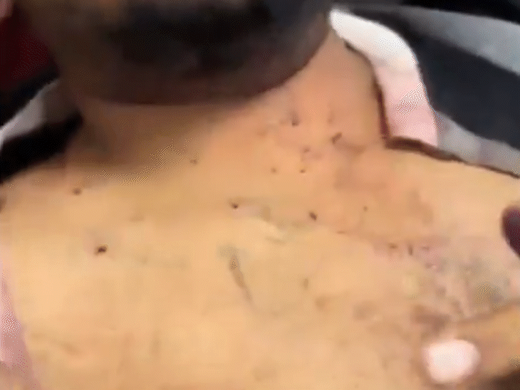 इरशाद के चेहरे और आंख पर पेलेट गन के छर्रे लगे हैं।