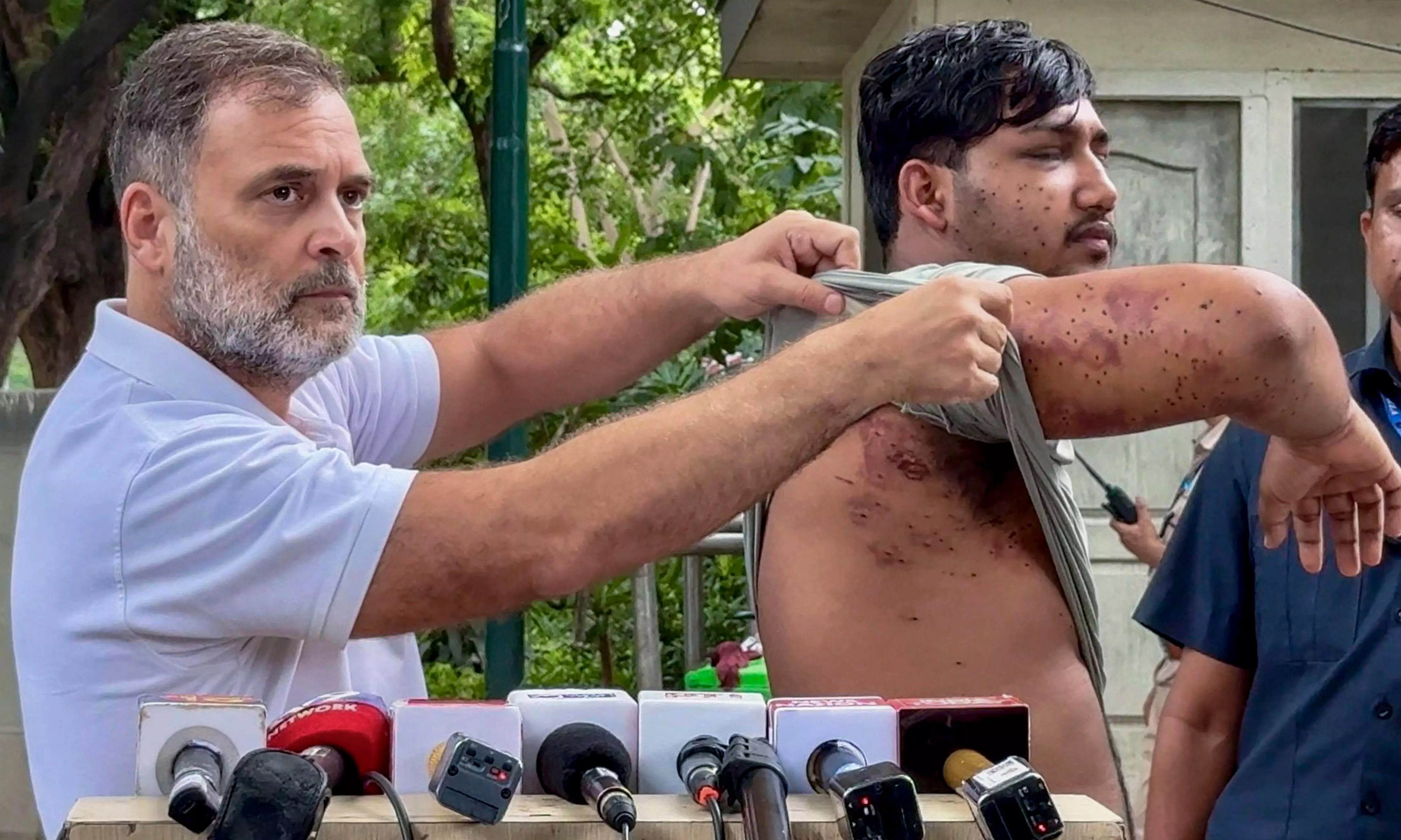 धर्मेंद्र प्रधान के इस्तीफे से एक दिन पहले राहुल ने प्रेस कॉन्फ्रेंस की। इसमें साहिल नाम के एक व्यक्ति पर पैलेट गन से हमला करने का दावा किया।