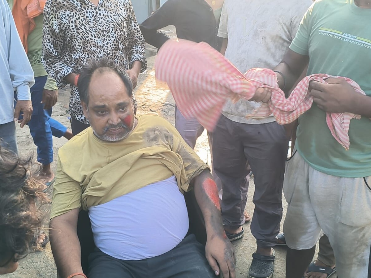 आक्रोशित लोगों ने चालक को पकड़कर जमकर पीटा, निजी अस्पताल में पीड़ित का चल रहा इलाज|शेरघाटी,Sherghati - Dainik Bhaskar