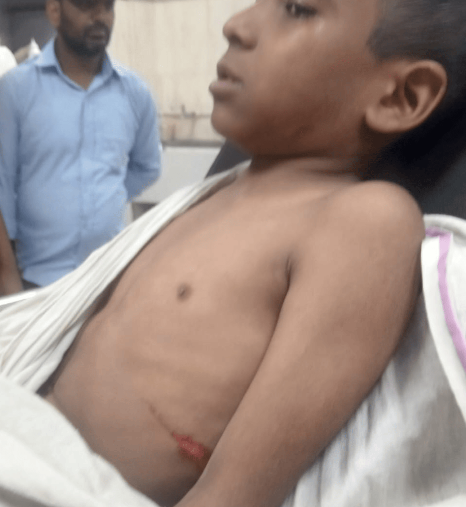 लेंटर गिरने से ध्रुव की टांग और यशवनी की पसलियां टूटी।