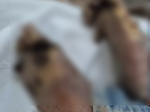 पानीपत की एकता कॉलोनी में करंट लगने से युवक के दोनों पैर बुरी तरह झुलस गए। - Dainik Bhaskar