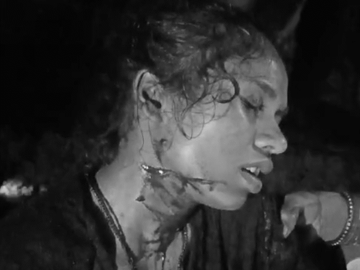 The woman has 24 stitches on her neck.